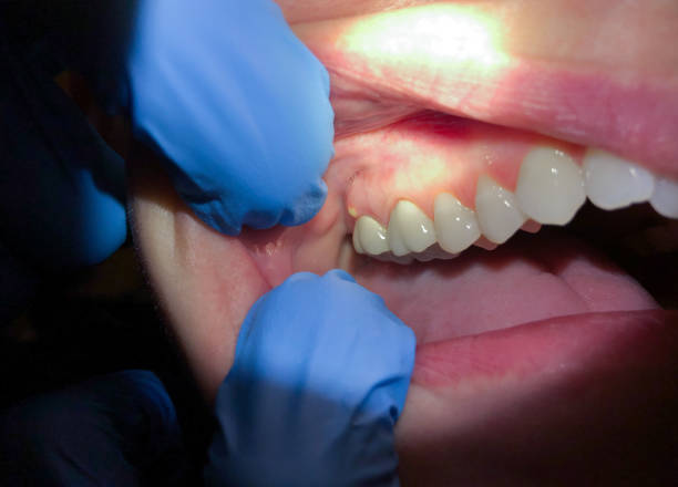 Best Emergency Root Canal Treatment in Ettrick, VA